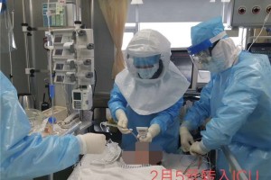 抢救36天运用康复者血浆3次东莞一重症患者康复 抢救36天运用康复者血浆3次东莞一重症患者康复