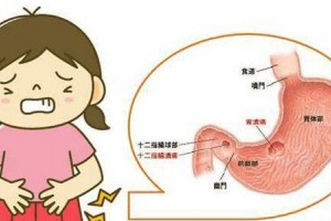 怎么防备胃溃疡癌变 怎么防备胃溃疡癌变