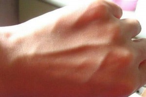 手上多处长出青筋可能是体内血管阻塞了这些双手信号别错过 手上多处长出青筋可能是体内血管阻塞了这些双手信号别错过