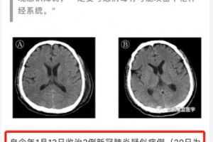 北上广三地首例病例确诊时刻并不是通报的1月20日 北上广三地首例病例确诊时刻并不是通报的1月20日