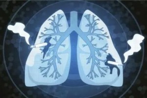 狐大医癌症会遗传直系亲属得了这四种癌你就要警觉了 狐大医癌症会遗传直系亲属得了这四种癌你就要警觉了