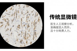 腾讯造出我国第一台临床使用智能显微镜使用远景广泛 腾讯造出我国第一台临床使用智能显微镜使用远景广泛
