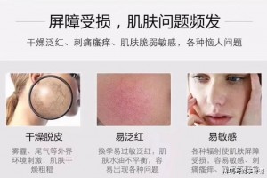 激素脸构成的原因有哪些?什么是激素脸怎样形成的 激素脸构成的原因有哪些?什么是激素脸怎样形成的