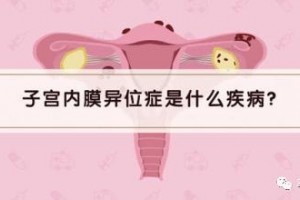 【科普小讲堂】子宫内膜处处乱跑——子宫内膜异位症 【科普小讲堂】子宫内膜处处乱跑——子宫内膜异位症